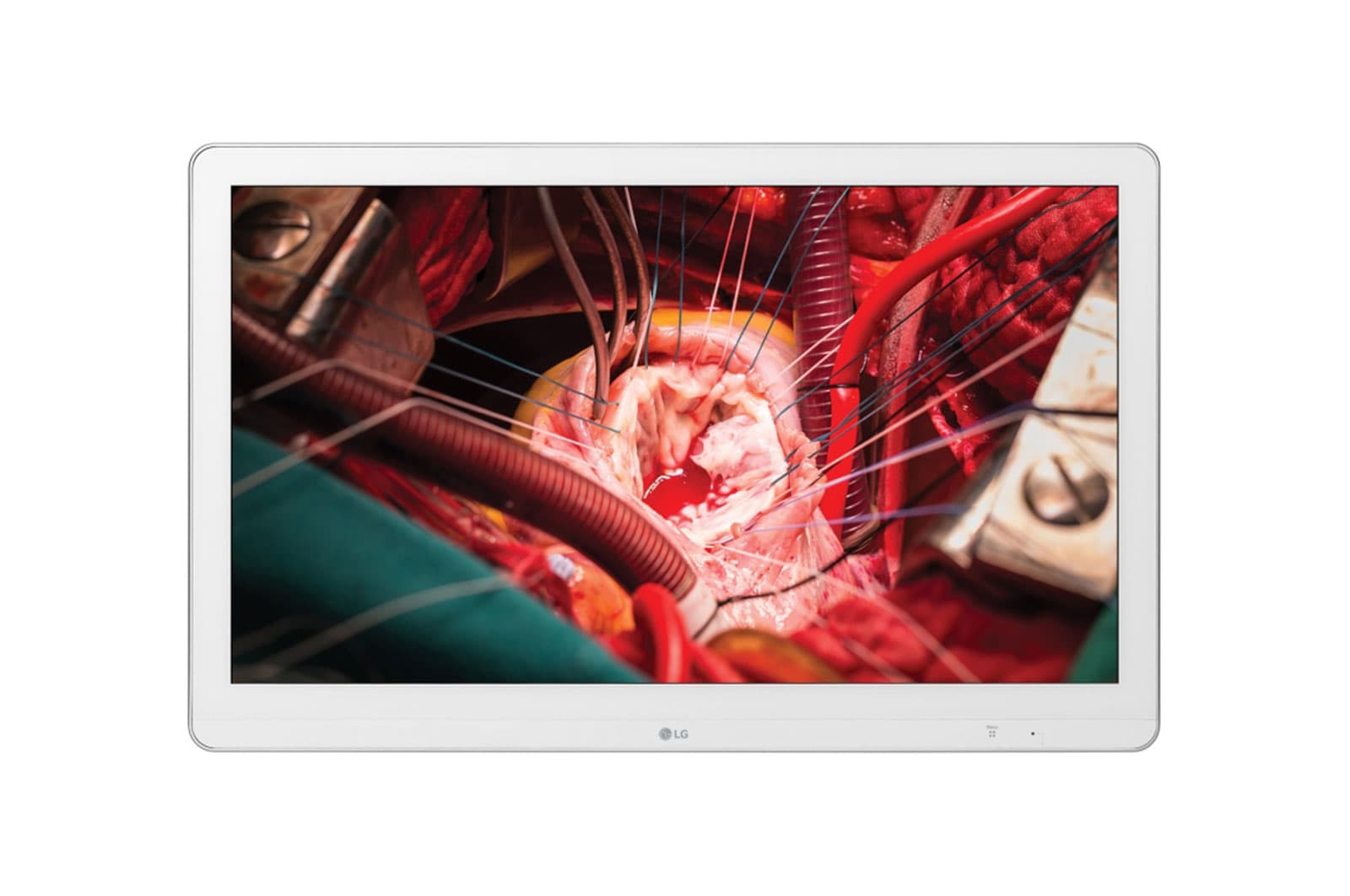 LG 27HK510S-W, miniatura 1