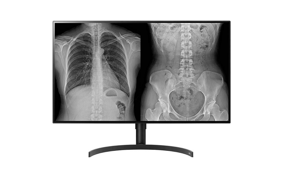 LG 32HL512D-M, imagem 1