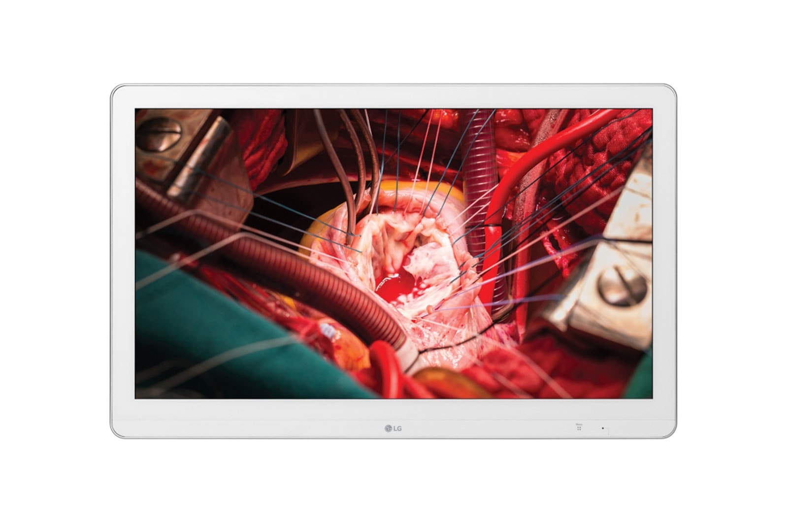 LG 27HK510S-W, imagem 1